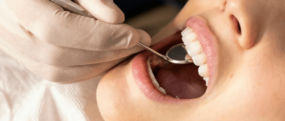 Goedkoopste tandartsverzekering 2026